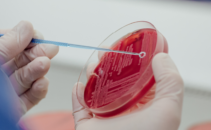 taking a sample. Ruminant disease